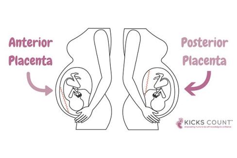 anterior and posterior placenta