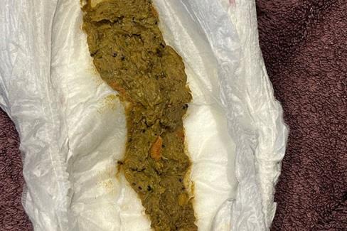 baby poo of 7 mo<em></em>nth old formula-fed baby with food bits in it