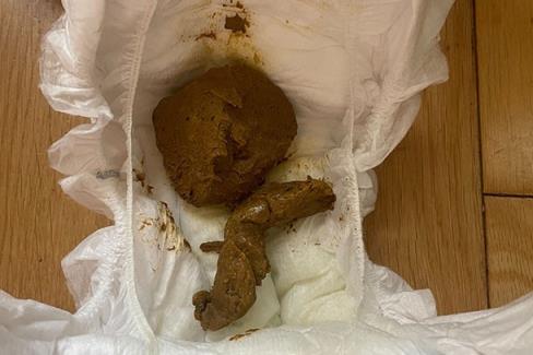 baby poo of 6 mo<em></em>nths old breastfed baby who has started on solids